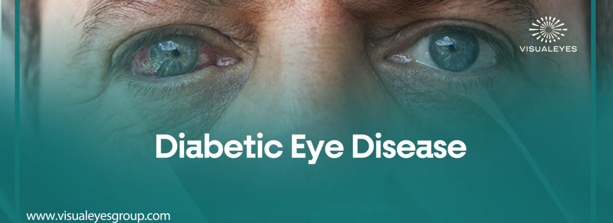 Shedding light on Diabetic eye disease: A call for awareness